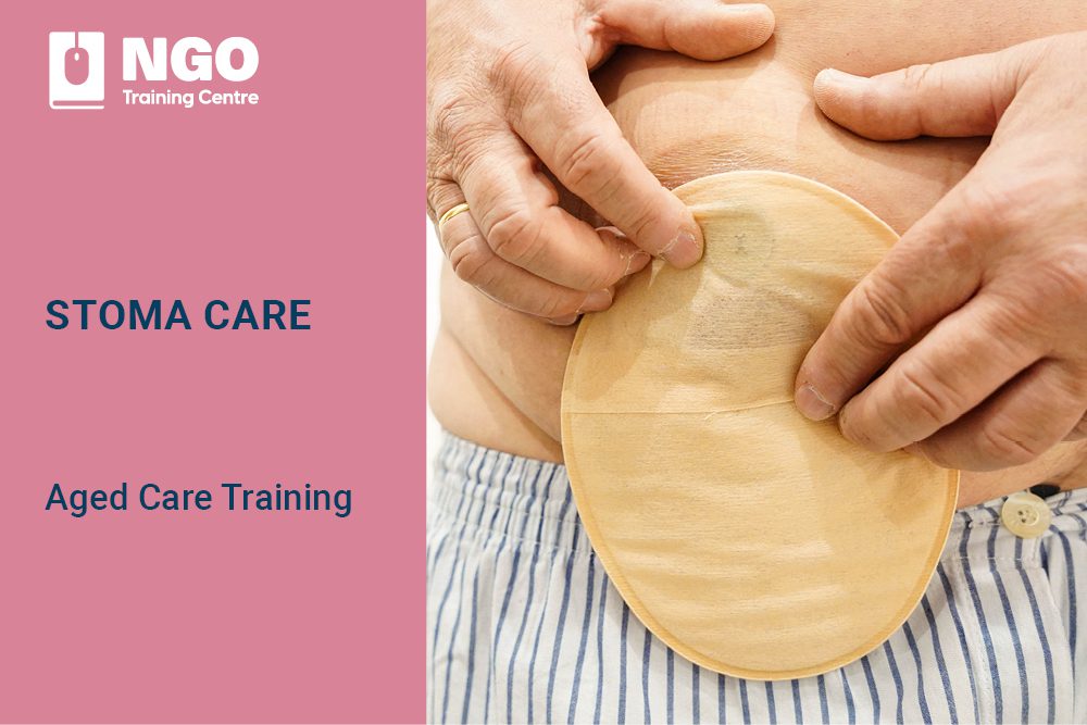 STOMA CARE COURSE - Online Aged Care Training by NGO Training Centre